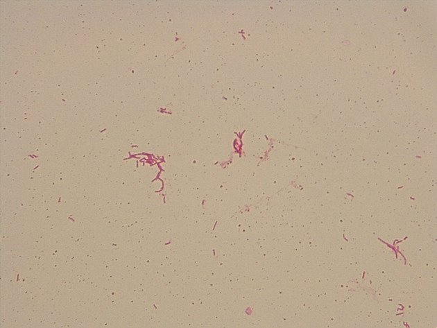 Bacillus Slides - Bacillus 02 400X